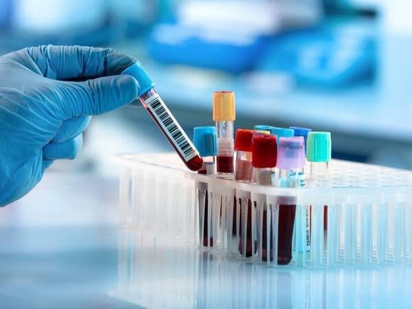 Advanced Medical Diagnostics